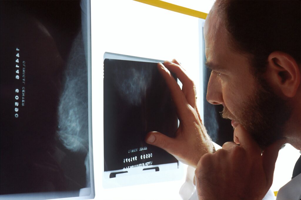Mammography